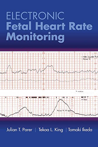 Electronic Fetal Heart Rate Monitoring: The 5-Tier System: The 5-Tier System