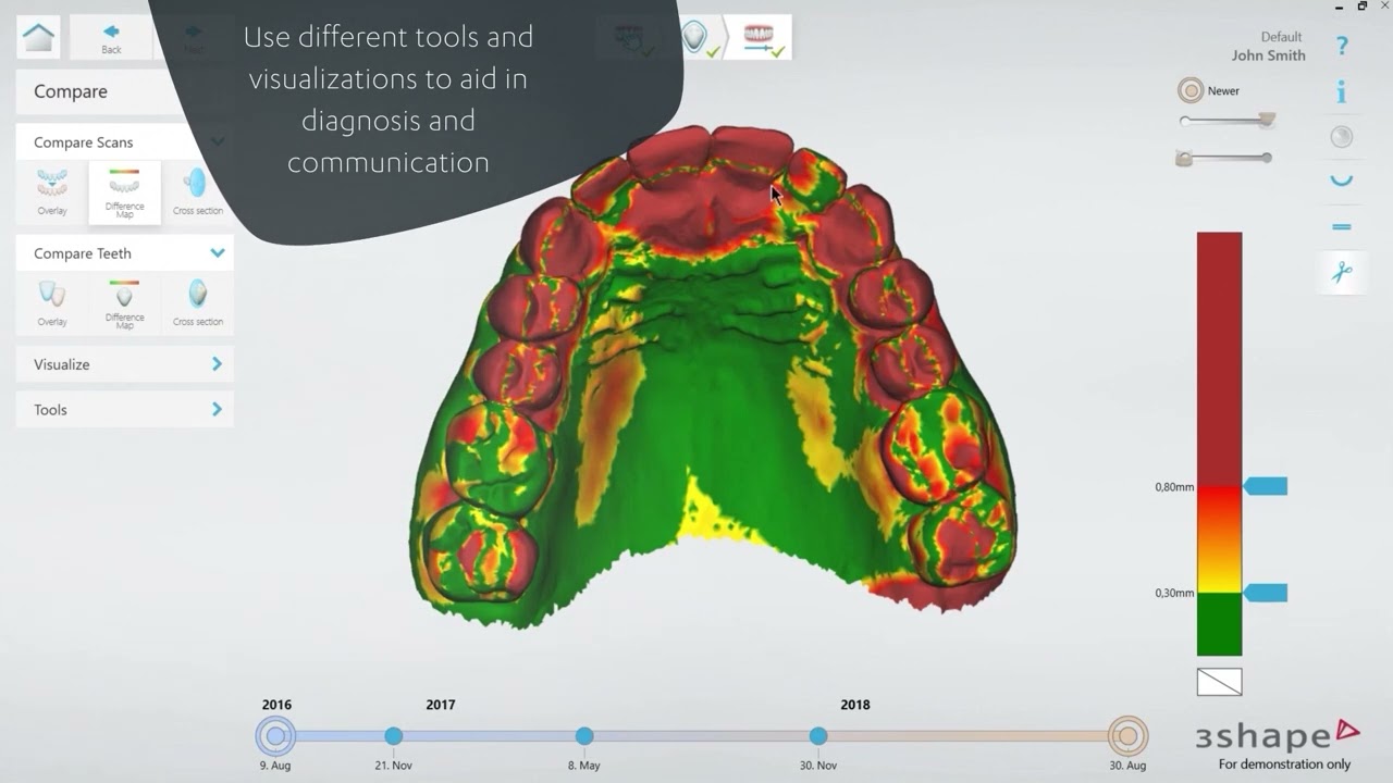 TRIOS Patient Monitoring Commercial video 2022