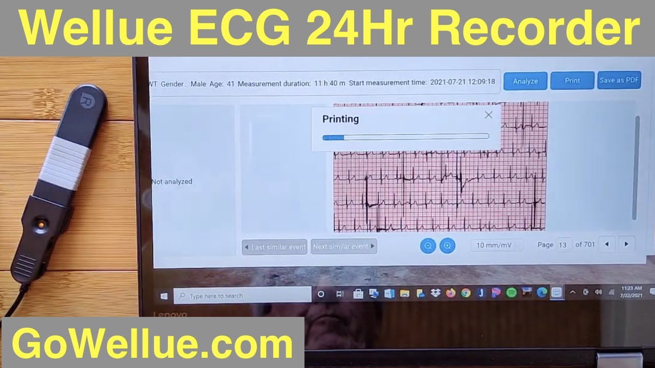 Wellue Heart Health Monitor with 24 hour Continuous ECG Recorder and AI Analysis: Unboxing & Review