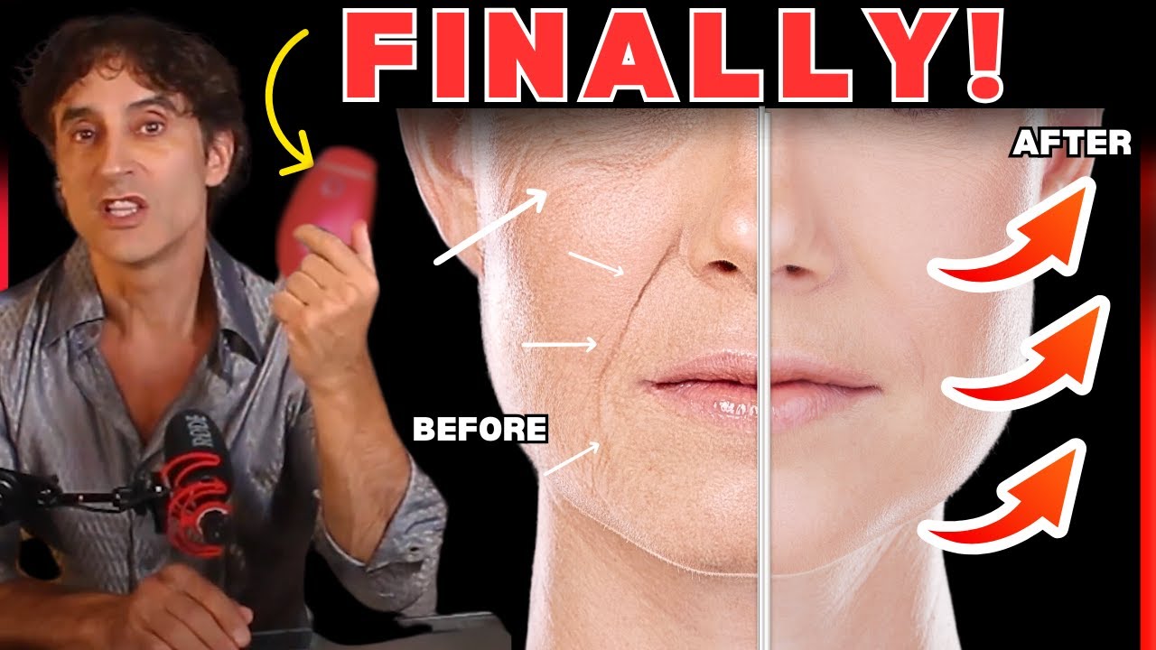 YOUR BEST RF At Home Skin Tightening Face Lifting Device // (( And Safest ))